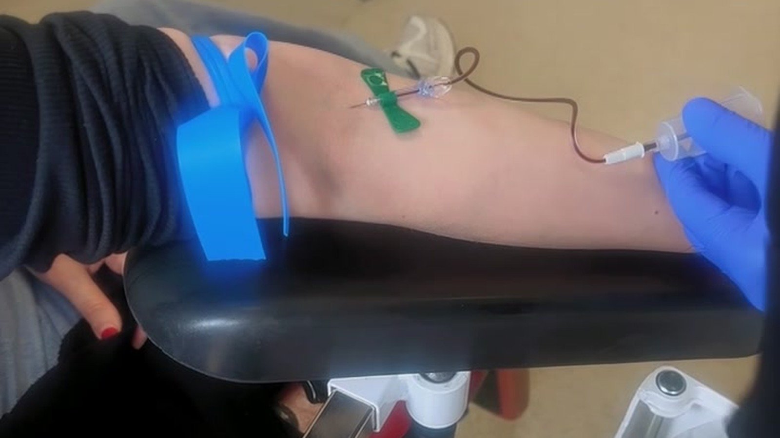Live blood draw on a real NHS patient — close-up of butterfly needle
